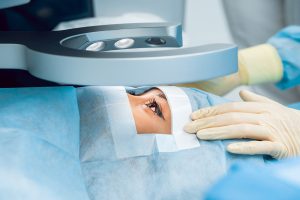 does medicare cover cataract surgery