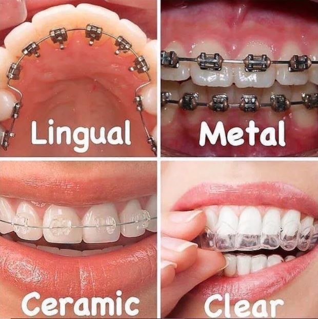  Image Source: Junior Dentist