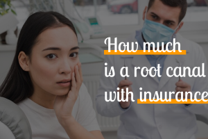 root-canal